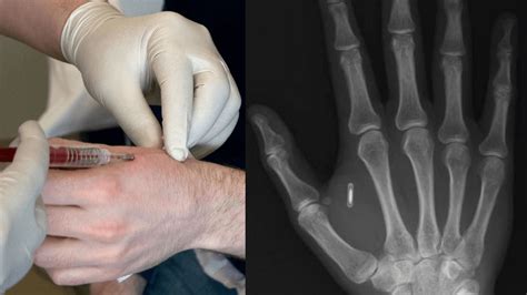 physics and rfid chips|who makes the rfid chip.